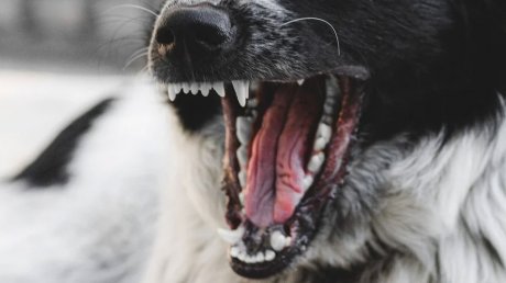 В Пензенской области собака напала на 10-летнюю девочку